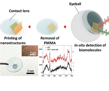 Glucose Contact Lens